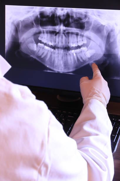 Best Emergency Dentist for Lost Fillings or Crowns in Farmingdale, NJ